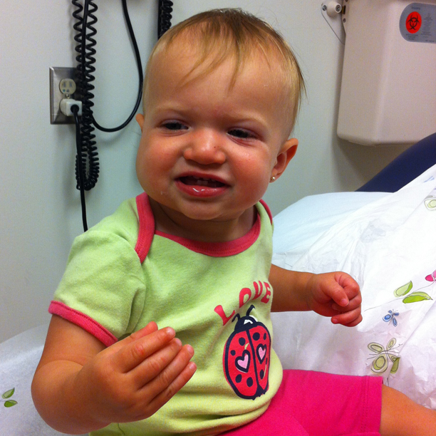 Hemangioma treatment complete - no more Propanolol @ohbotherblog