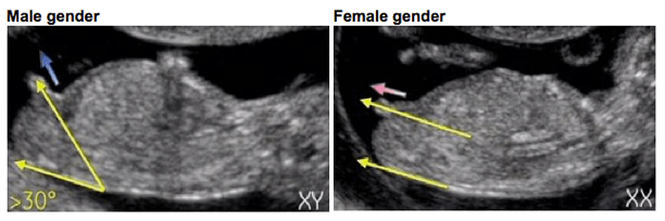 the angle of the&nbsp;dangle