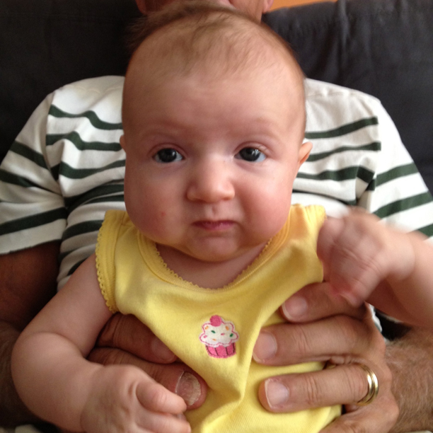 What a deep hemangioma looks like on a 3-month-old @ohbotherblog